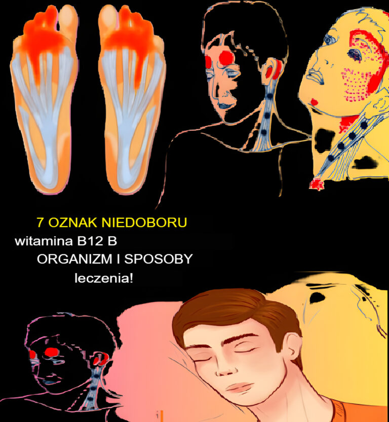 7_objaw_w_niedoboru_witaminy_B12_i_jak_go_leczy__