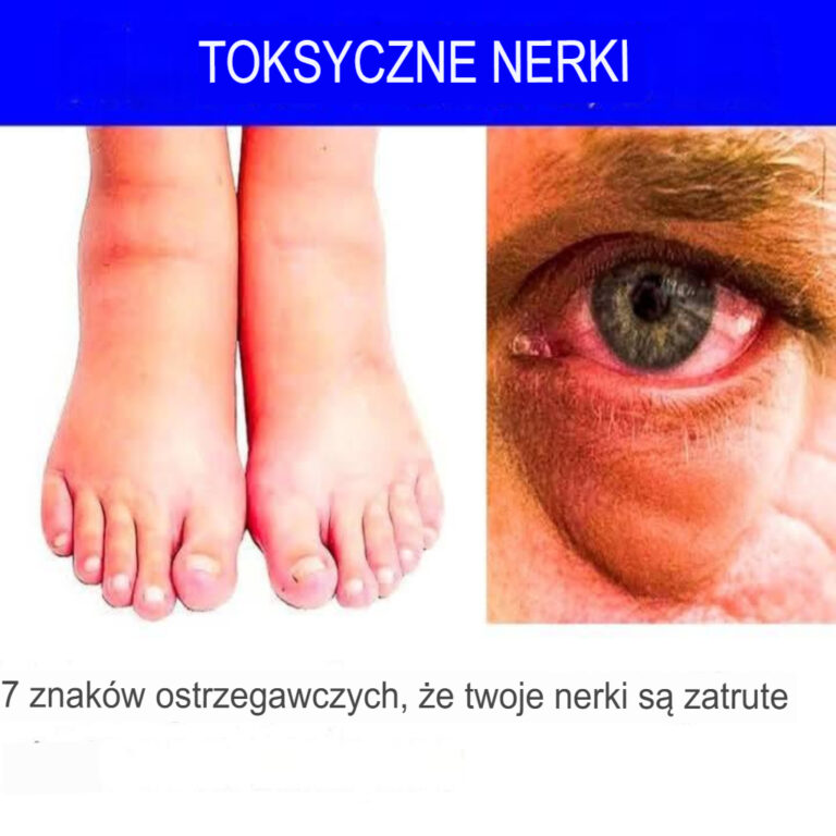 7_ostrzegawczych_sygna__w___e_Twoje_nerki_s__toksyczne