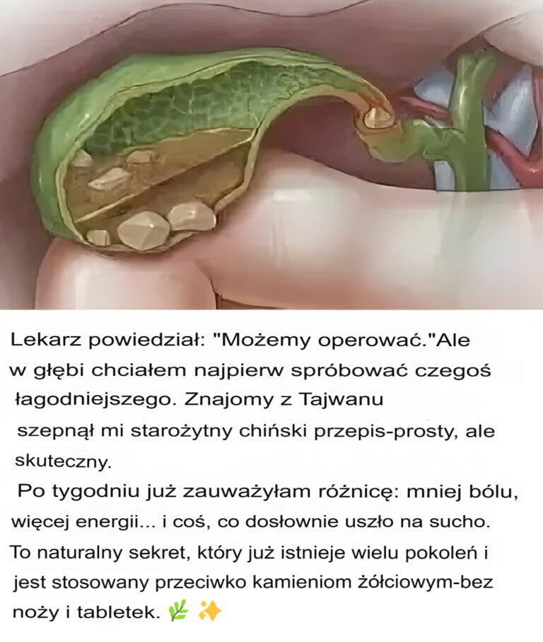 Chi_ski_przepis_na_naturalne_usuwanie_kamieni____ciowych