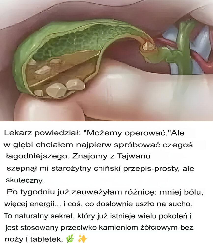 Chi_ski_przepis_na_naturalne_usuwanie_kamieni____ciowych Chi_ski_przepis_na_naturalne_usuwanie_kamieni____ciowych