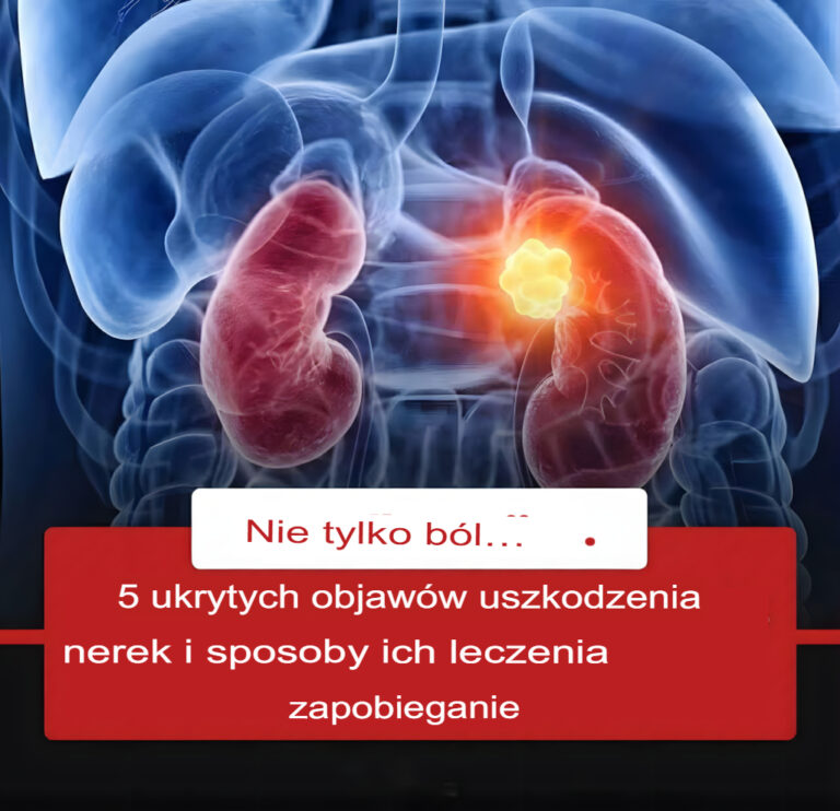Ciche_objawy_uszkodzenia_nerek_i_metody_zapobiegania