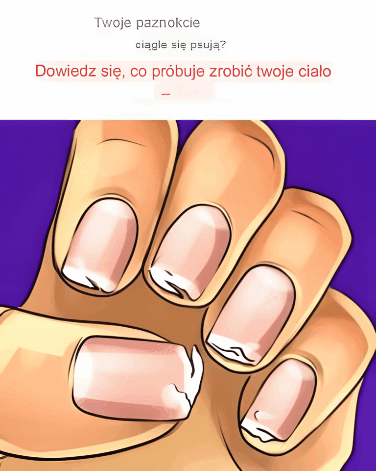 Czy_Twoje_paznokcie_ci_gle_p_kaj__lub_si__rozdwajaj___To_sygna___kt_ry_pr_buje_Ci_wys_a__Twoje_cia_o_