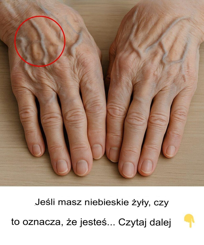 Dlaczego__y_y_staj__si__bardziej_widoczne_z_wiekiem Dlaczego__y_y_staj__si__bardziej_widoczne_z_wiekiem