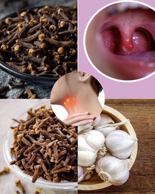 Go_dziki_na_b_l_gard_a__naturalny_spos_b_na_zmniejszenie_stanu_zapalnego_i_przyspieszenie_gojenia Go_dziki_na_b_l_gard_a__naturalny_spos_b_na_zmniejszenie_stanu_zapalnego_i_przyspieszenie_gojenia