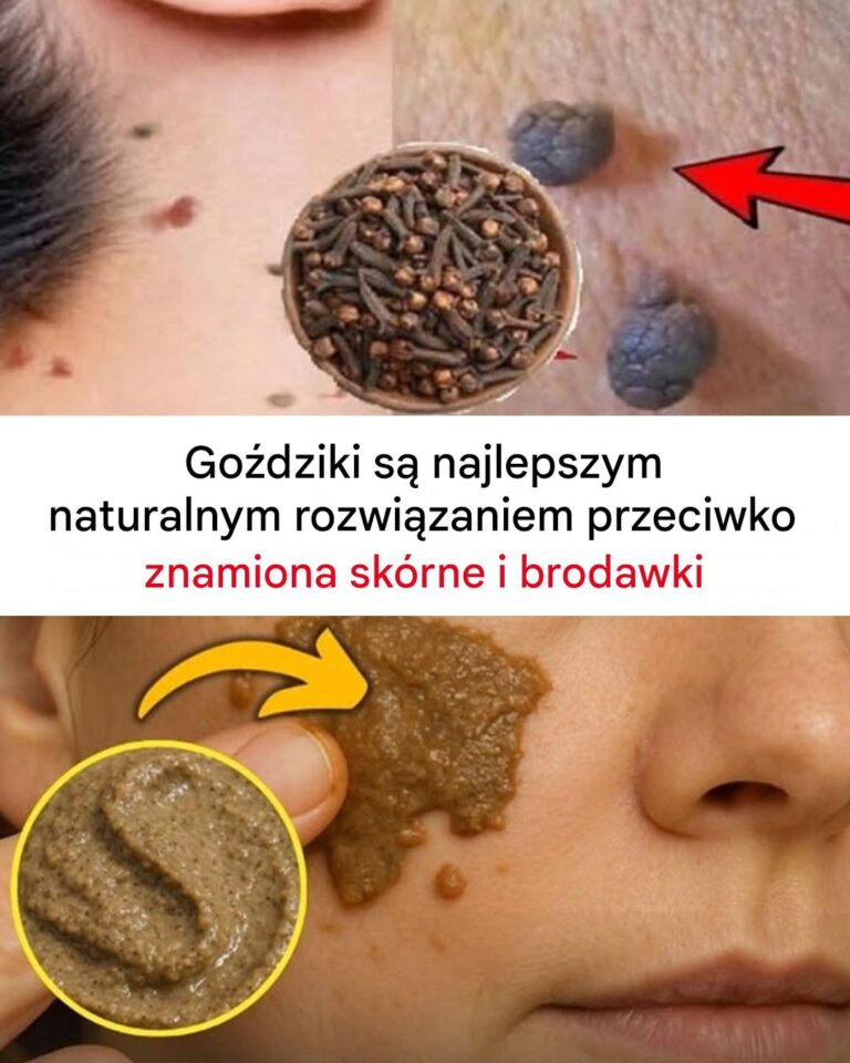 Go_dziki_usuwaj__naro_la_sk_rne_i_brodawki__Jak_je_stosowa__