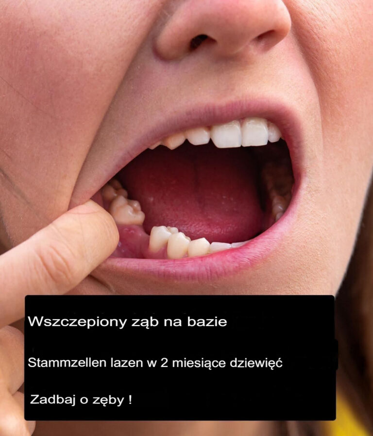 Implanty_stomatologiczne_na_bazie_kom_rek_macierzystych_mog__w_przysz_o_ci_zast_pi__protezy_z_bowe