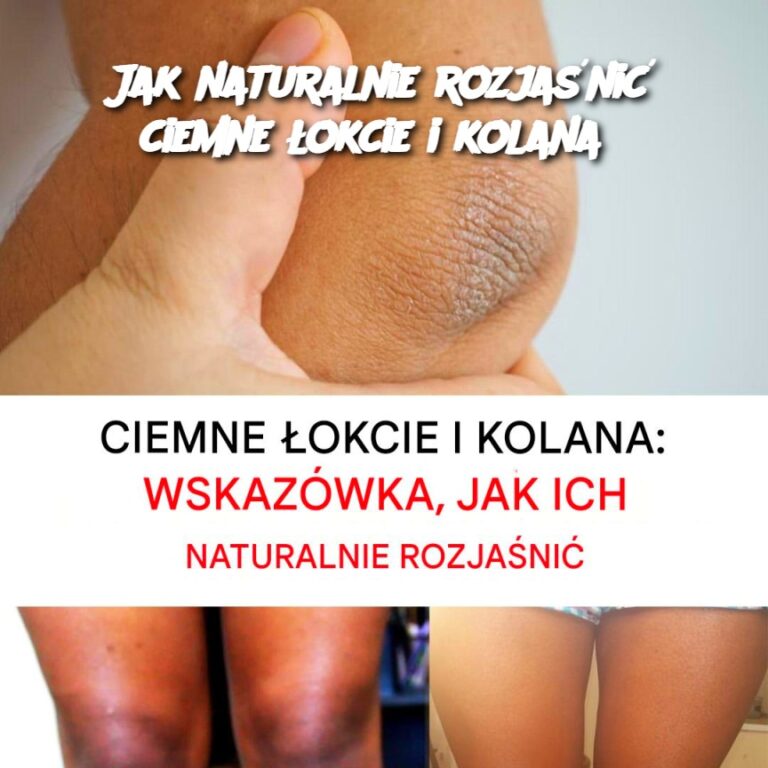 Jak_naturalnie_rozja_ni__ciemne__okcie_i_kolana_