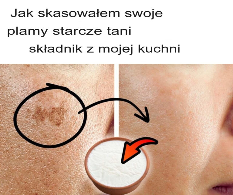 Jak_pozby_am_si__plam_starczych_za_pomoc__taniego_sk_adnika_z_mojej_kuchni