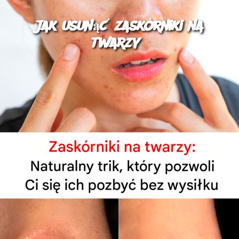 Jak_usun___zask_rniki_na_twarzy_