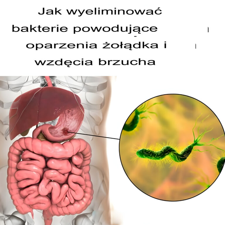 Jak_wyeliminowa__bakterie_powoduj_ce_zgag__i_wzd_cia