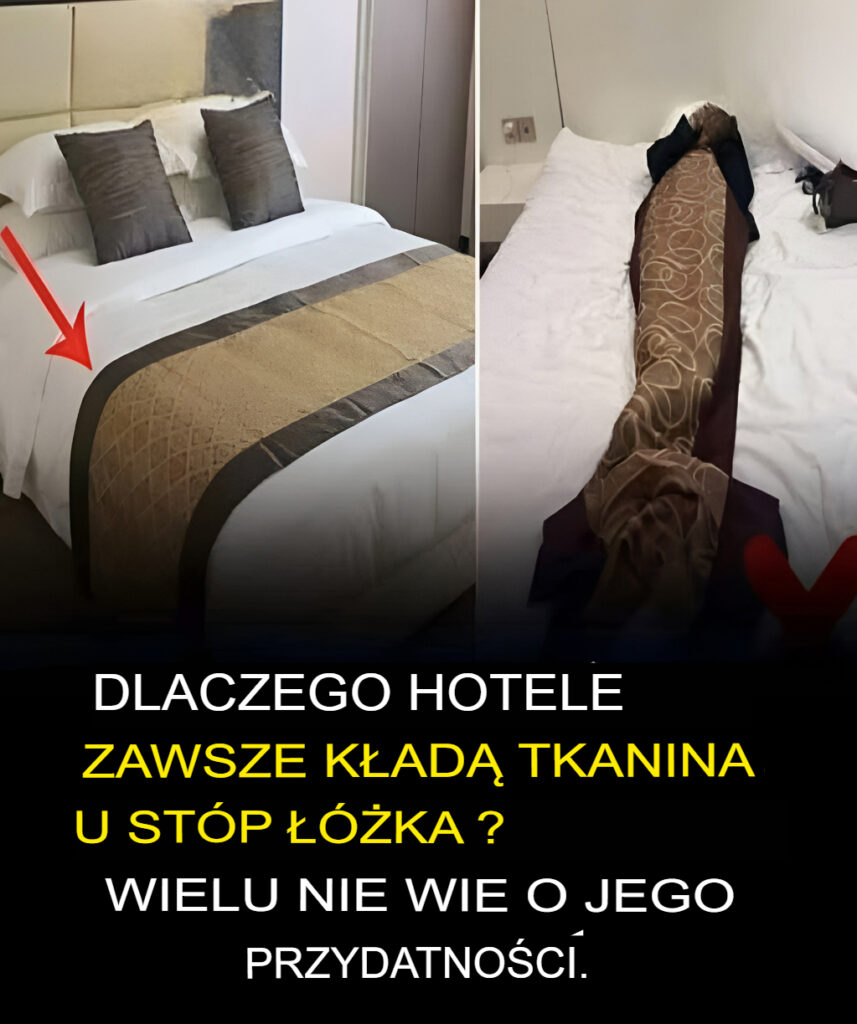 Jaki_jest_cel_stosowania_pasa_materia_u_na____kach_hotelowych_-2 Jaki_jest_cel_stosowania_pasa_materia_u_na____kach_hotelowych_-2