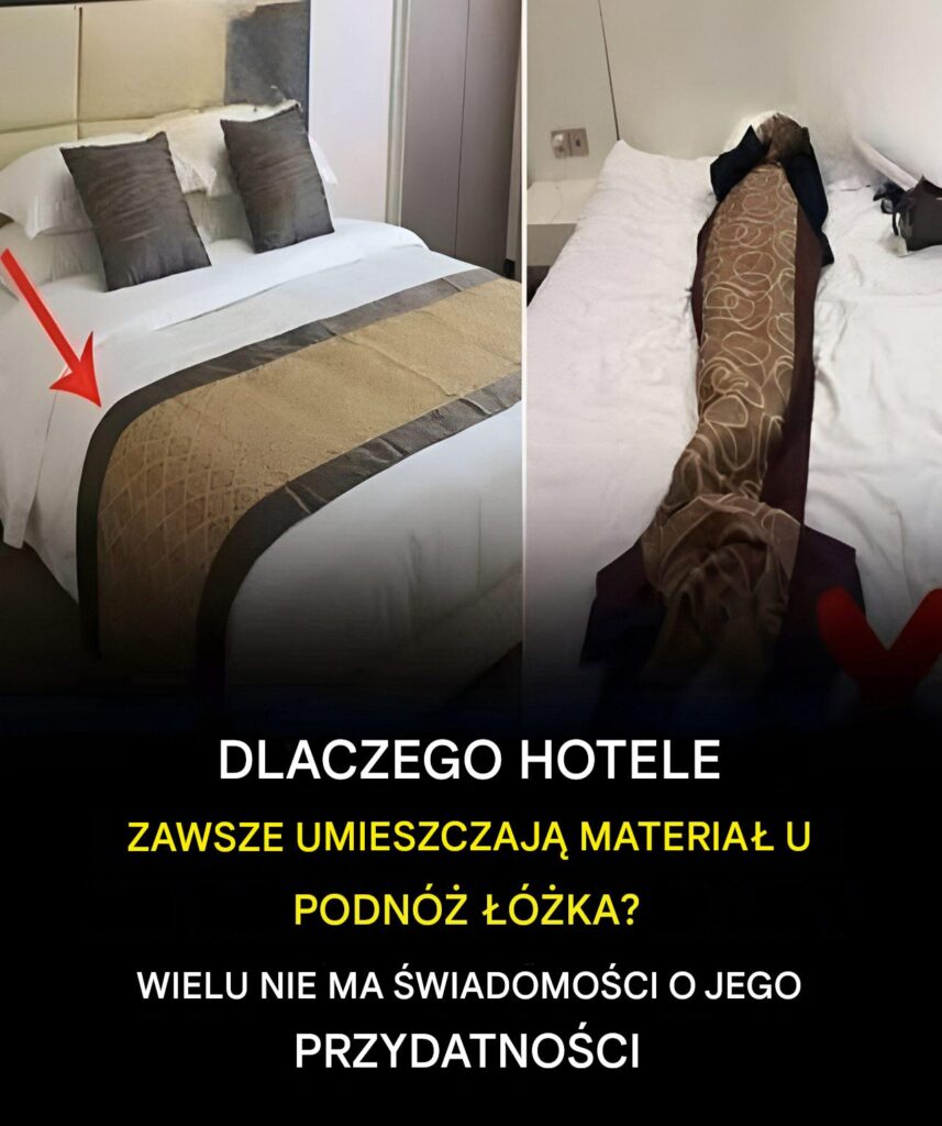 Jaki_jest_cel_stosowania_pasa_materia_u_na____kach_hotelowych_ Jaki_jest_cel_stosowania_pasa_materia_u_na____kach_hotelowych_