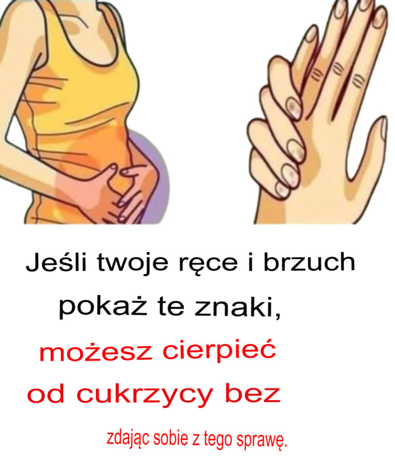 Je_li_Twoje_d_onie_i_brzuch_wykazuj__takie_objawy__mo_esz_cierpie__na_cukrzyc___nie_zdaj_c_sobie_z_tego_sprawy
