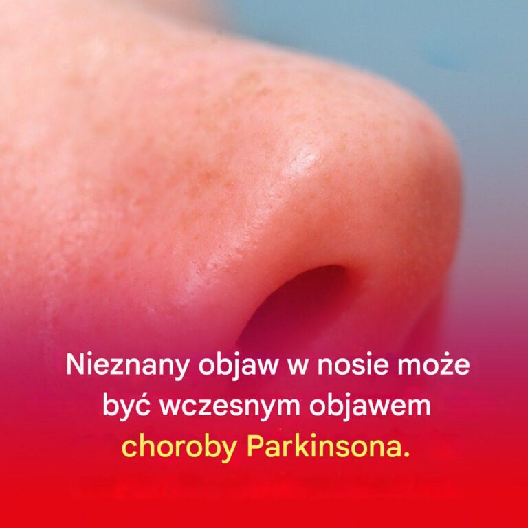 Ma_o_znany_objaw_w_nosie_mo_e_by__wczesnym_objawem_choroby_Parkinsona_
