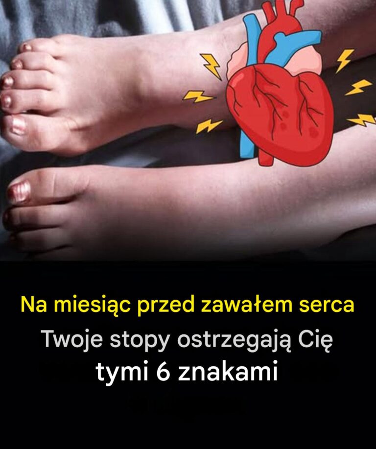 Miesi_c_przed_zawa_em_serca_Twoje_stopy_mog__Ci__ostrzec_tymi_6_znakami