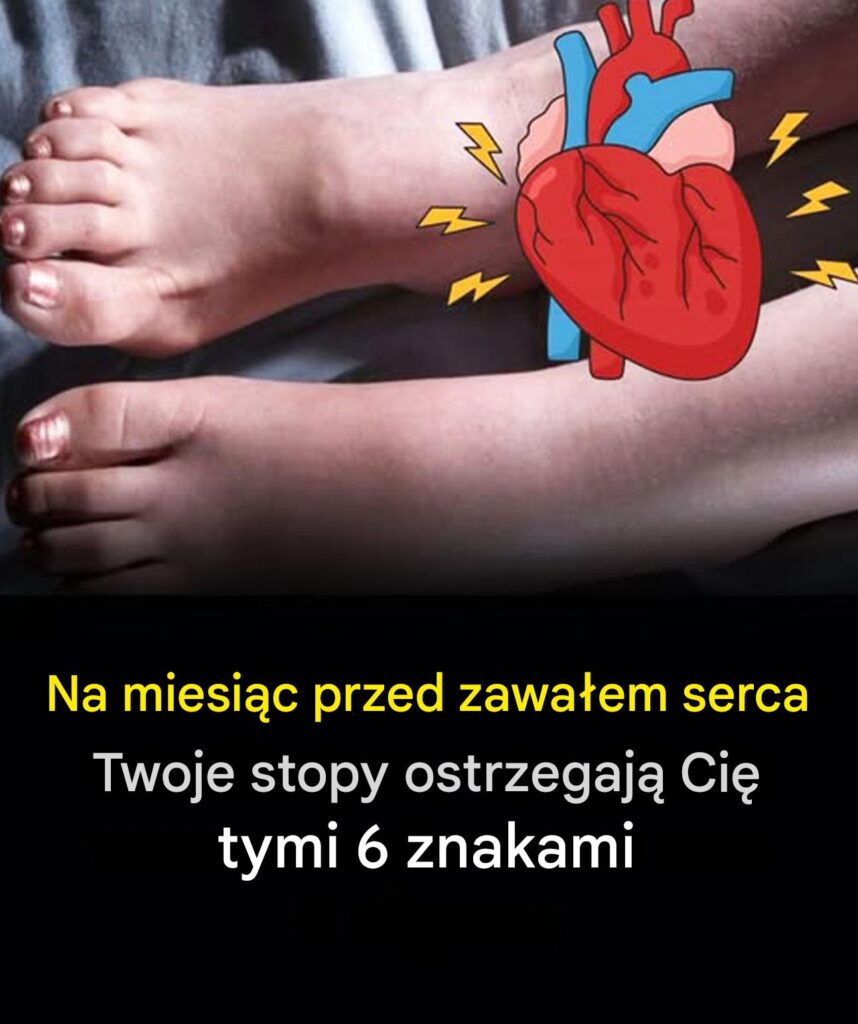 Miesi_c_przed_zawa_em_serca_Twoje_stopy_mog__Ci__ostrzec_tymi_6_znakami