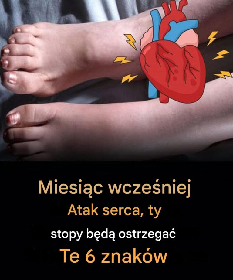 Miesi_c_przed_zawa_em_serca_Twoje_stopy_ostrzegaj__Ci__przed_tymi_6_objawami