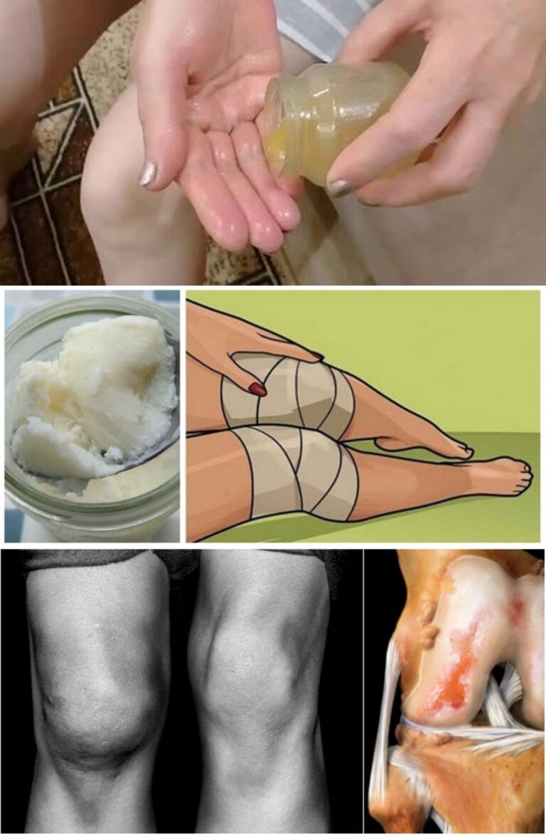 Naturalne_rozwi_zania_dla_os_b_cierpi_cych_na_b_le_staw_w_i_kolan