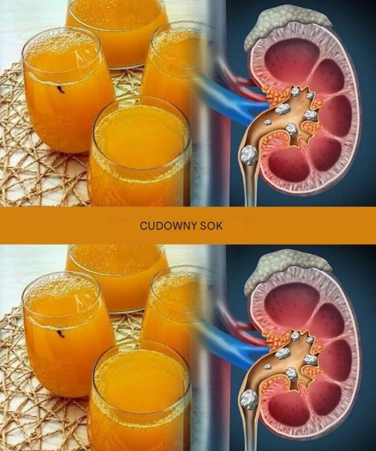 Naturalnie_oczy___nerki__w_trob__i_p_uca__aby_przywr_ci__witalno___i_og_lne_dobre_samopoczucie