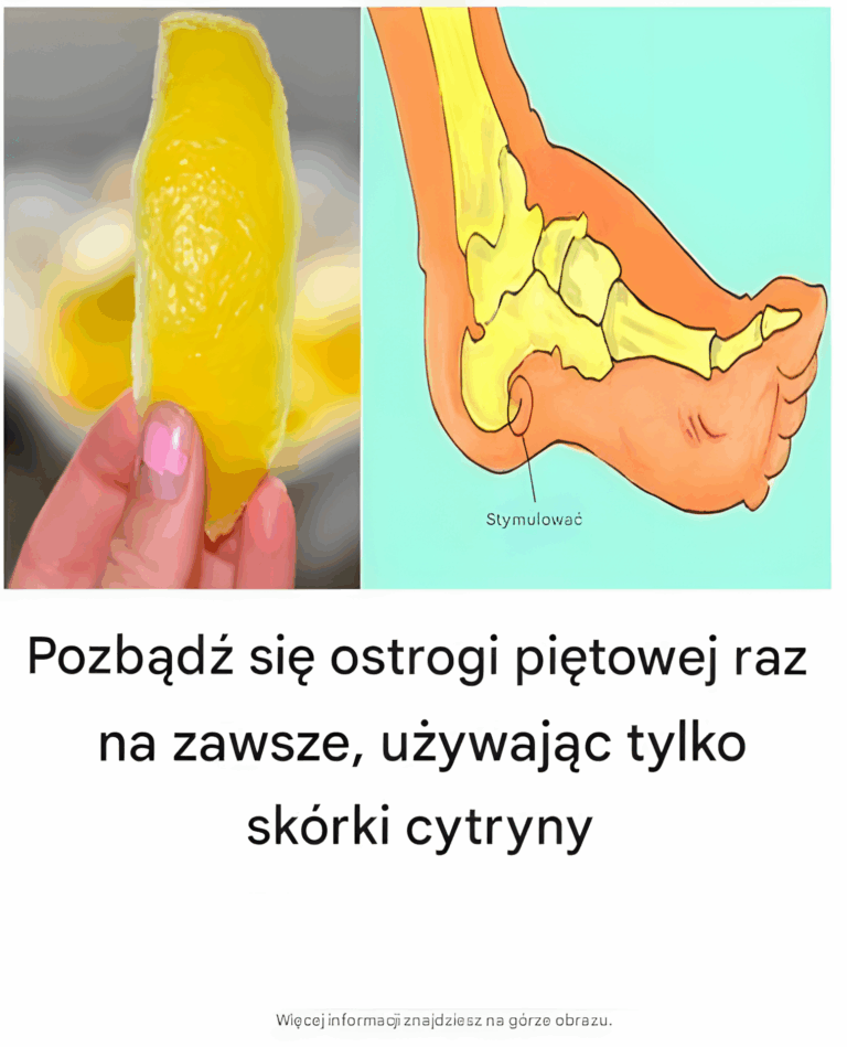 Naturalny_spos_b_na_ostrog__pi_tow___Terapia_z_u_yciem_sk_rki_cytrynowej