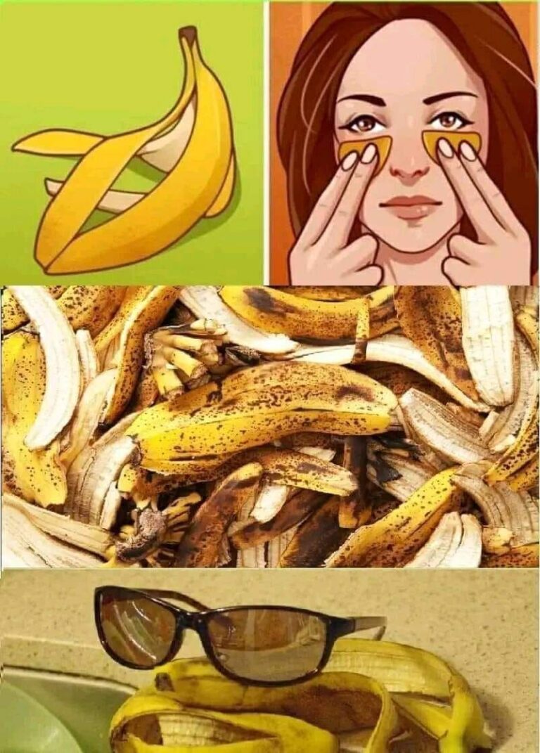 Nie_wyrzucaj_sk_rek_od_banan_w___oto_7_niezb_dnych_zastosowa_
