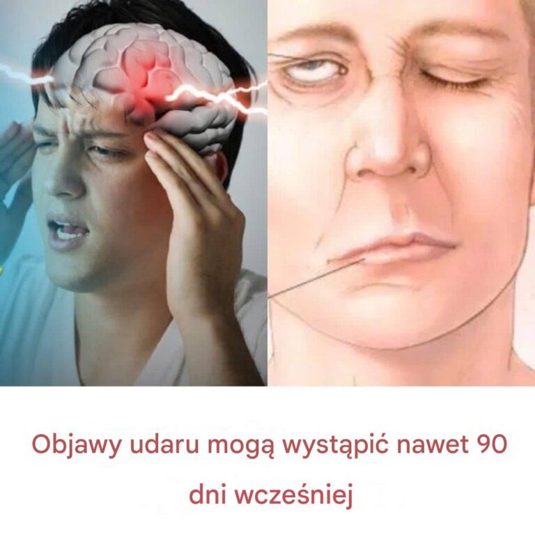 Objawy_udaru_mog__wyst_pi__nawet_90_dni_wcze_niej-1