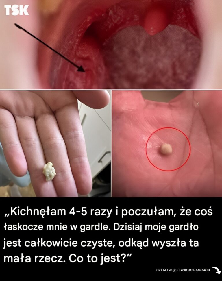 Oto__co_musisz_wiedzie__o_kamieniach_migda_kowych