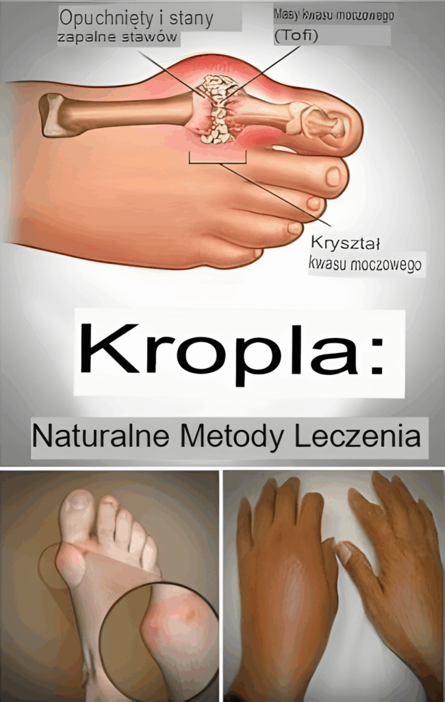 Po_egnaj_si__z_dn__moczanow__na_zawsze_dzi_ki_temu_skutecznemu__naturalnemu_sposobowi_leczenia_ Po_egnaj_si__z_dn__moczanow__na_zawsze_dzi_ki_temu_skutecznemu__naturalnemu_sposobowi_leczenia_