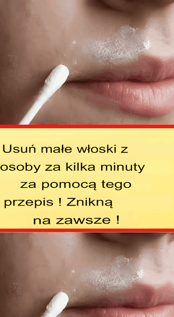 Ta_naturalna_receptura_na_sta_e_usunie_w_oski_z_twarzy Ta_naturalna_receptura_na_sta_e_usunie_w_oski_z_twarzy
