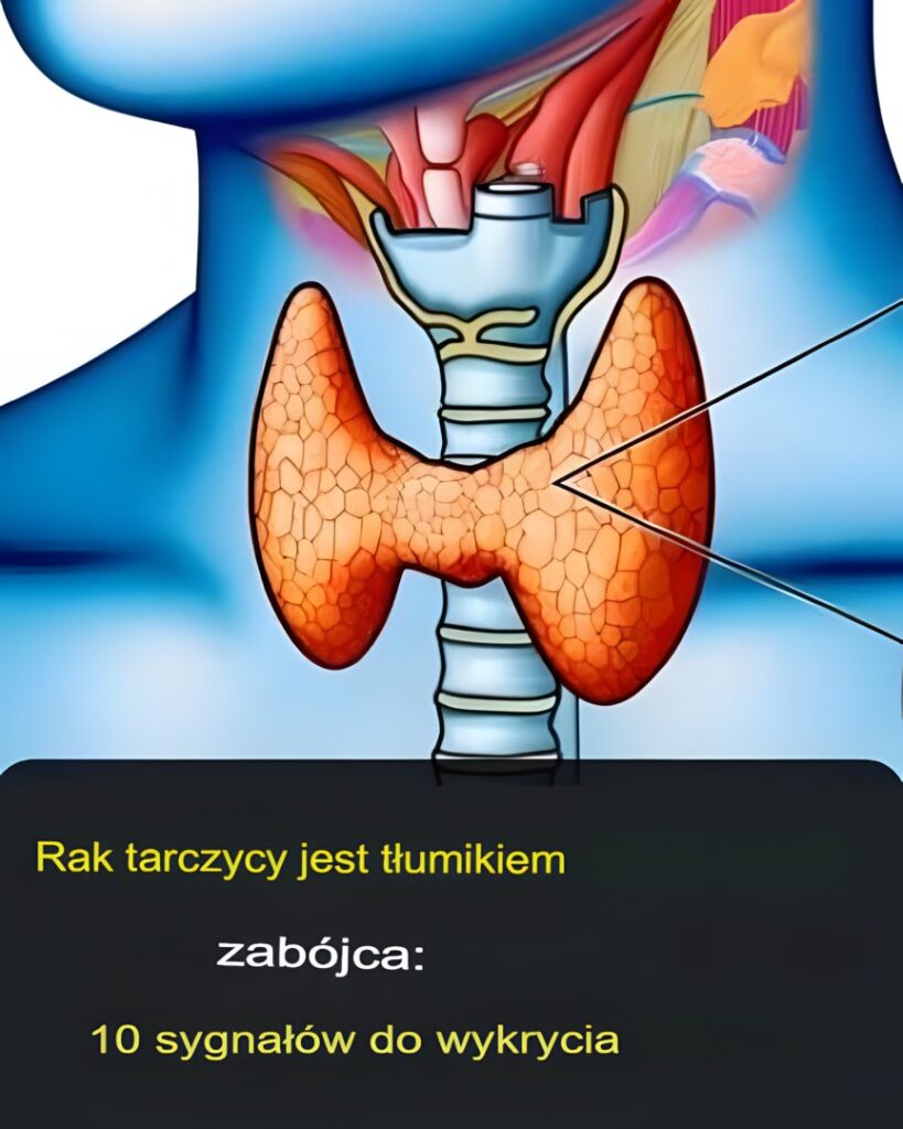 Tarczyca__3_objawy__kt_re_mog__wskazywa__na_nowotw_r-1 Tarczyca__3_objawy__kt_re_mog__wskazywa__na_nowotw_r-1
