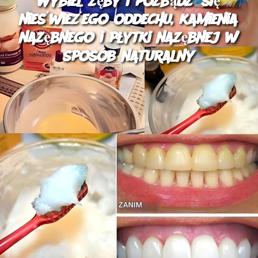 Wybiel_z_by_i_pozb_d__si__nie_wie_ego_oddechu__kamienia_naz_bnego_i_p_ytki_naz_bnej_w_spos_b_naturalny