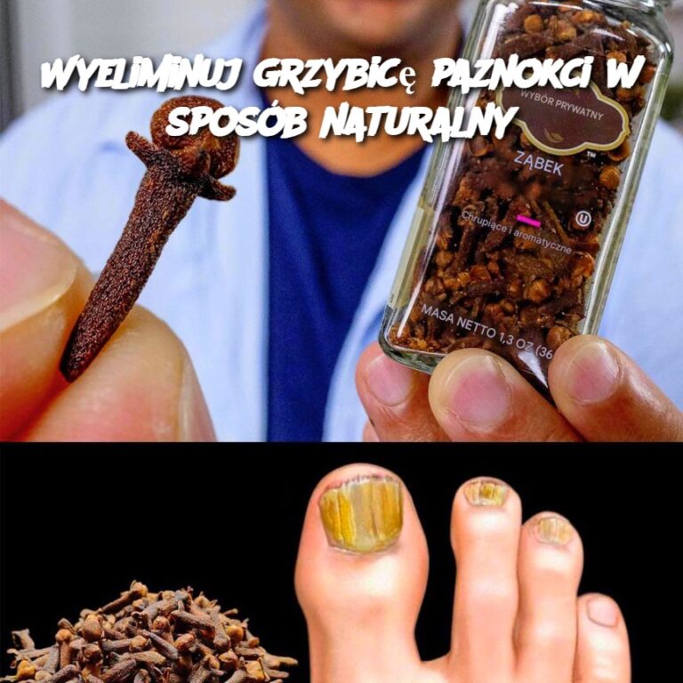 Wyeliminuj_grzybic__paznokci_w_spos_b_naturalny