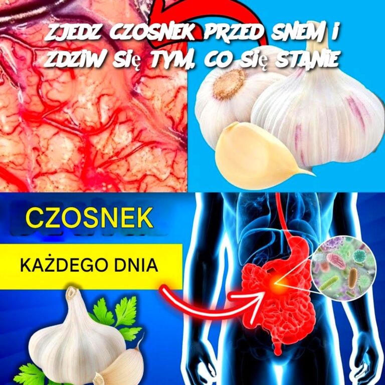 Zjedz_czosnek_przed_snem_i_zdziw_si__tym__co_si__stanie
