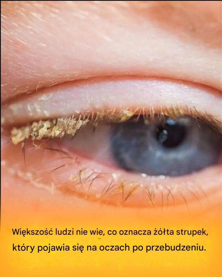 ty_strup_po_przebudzeniu__co_to_oznacza_
