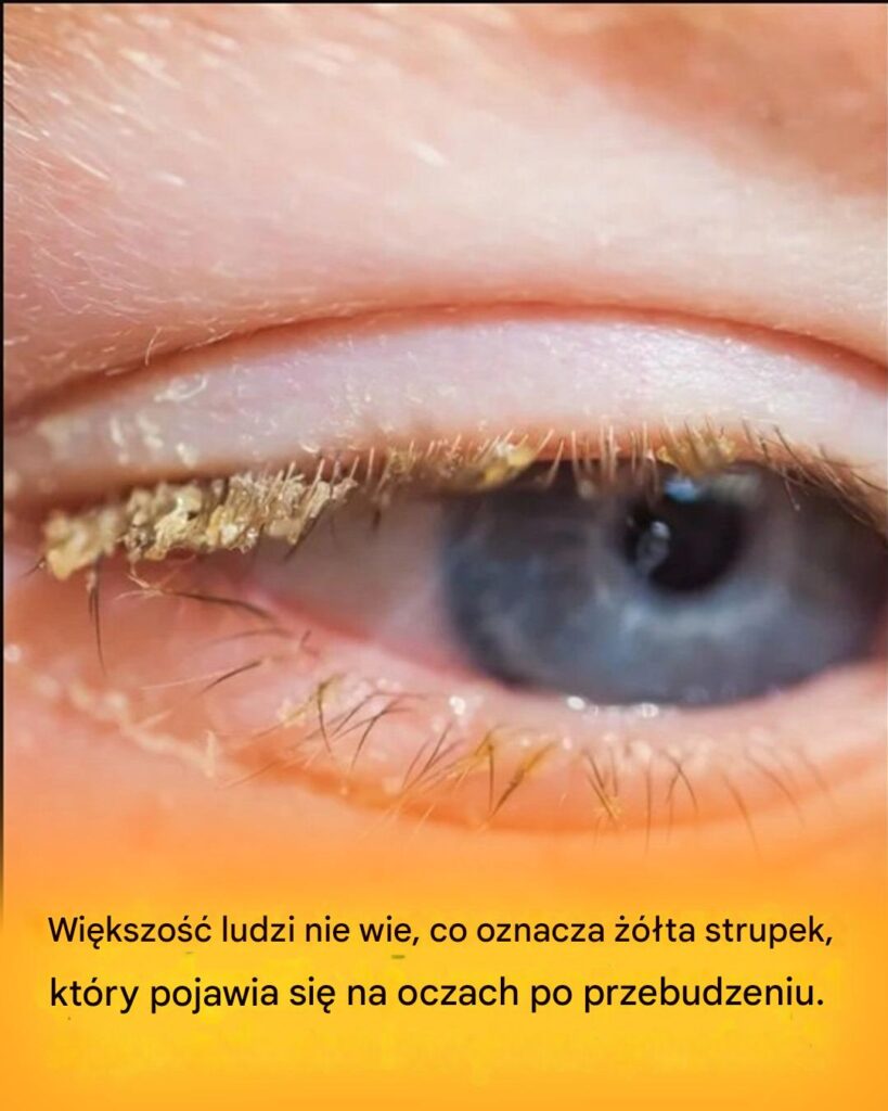 ty_strup_po_przebudzeniu__co_to_oznacza_ ty_strup_po_przebudzeniu__co_to_oznacza_