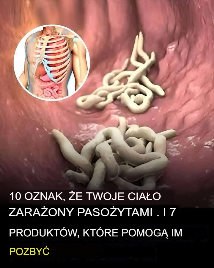 10_oznak___e_w_Twoim_organizmie_jest_pe_no_paso_yt_w 10_oznak___e_w_Twoim_organizmie_jest_pe_no_paso_yt_w