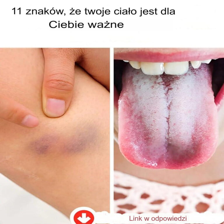 11_wyra_nych_oznak___e_Twoje_cia_o_komunikuje_si__z_Tob_
