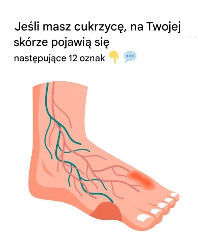 12_dziwnych_problem_w_sk_rnych_zwi_zanych_z_cukrzyc___o_kt_rych_musisz_wiedzie_