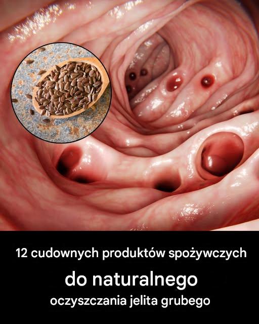 12_superprodukt_w__kt_re_naturalnie_oczyszcz__Twoje_jelito_grube-1 12_superprodukt_w__kt_re_naturalnie_oczyszcz__Twoje_jelito_grube-1
