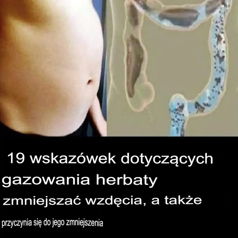 19_naturalnych_wskaz_wek__jak_z_agodzi__wzd_cia_i_uzyska__lekki__o__dek