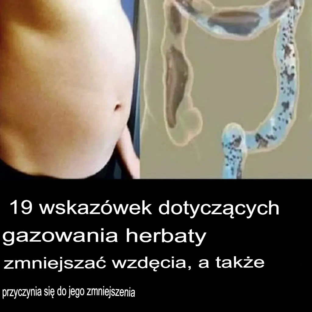 19_naturalnych_wskaz_wek__jak_z_agodzi__wzd_cia_i_uzyska__lekki__o__dek 19_naturalnych_wskaz_wek__jak_z_agodzi__wzd_cia_i_uzyska__lekki__o__dek