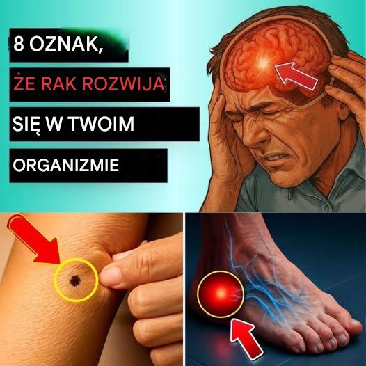 20_wczesnych_oznak___e_twoje_cia_o_walczy_z_rakiem 20_wczesnych_oznak___e_twoje_cia_o_walczy_z_rakiem