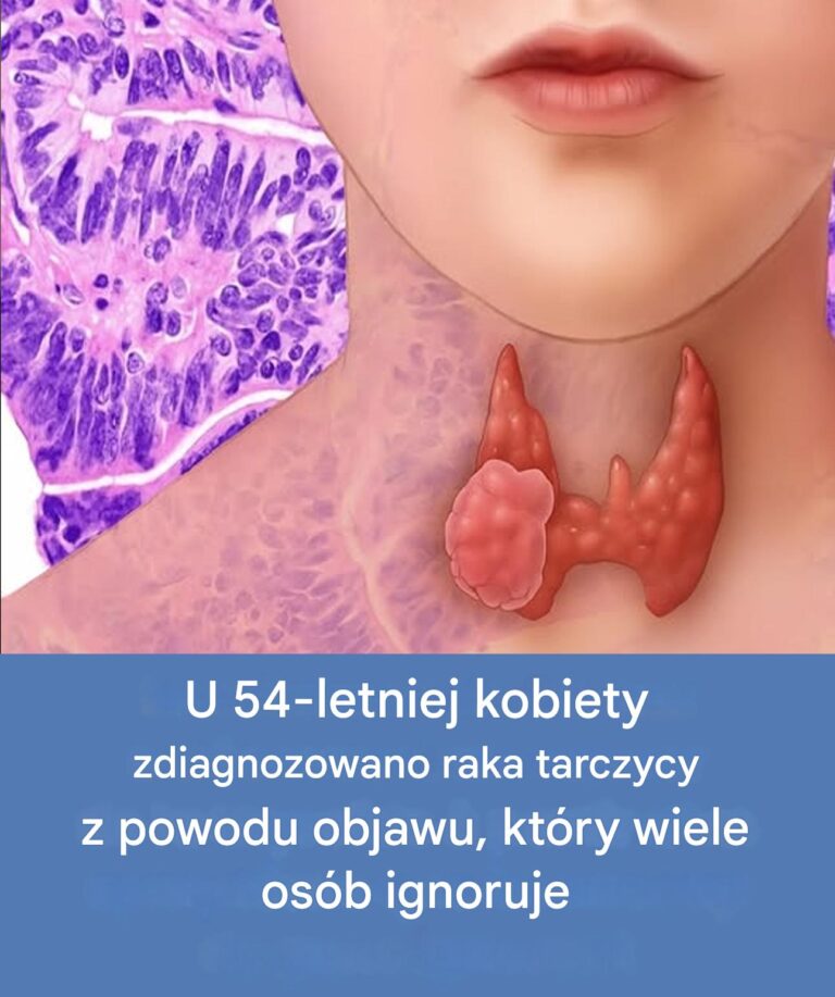 54_letnia_kobieta_dowiedzia_a_si____e_ma_raka_tarczycy__co_cz_sto_pozostaje_niezauwa_one-1