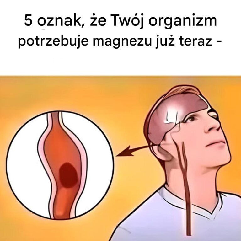 5_oznak__kt_re_mog__wskazywa__na_niedob_r_magnezu-1
