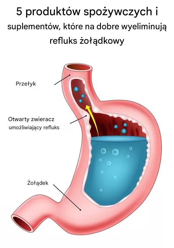 5_witamin__kt_re_naturalnie_zapobiegaj__refluksowi_kwasu__o__dkowego-1 5_witamin__kt_re_naturalnie_zapobiegaj__refluksowi_kwasu__o__dkowego-1