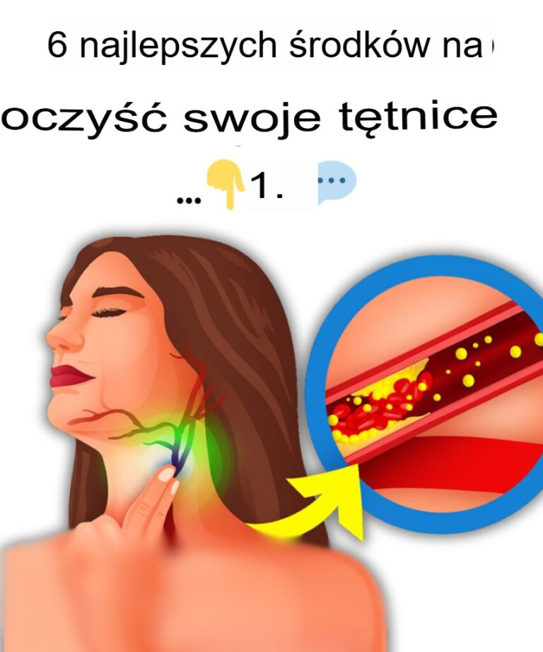 6_najlepszych_sposob_w_na_oczyszczenie_t_tnic
