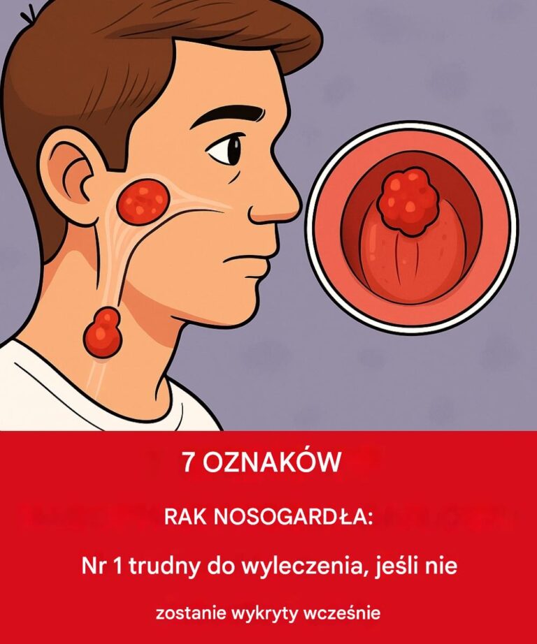 7_objaw_w_raka_nosogard_a__nr_1_jest_trudny_do_leczenia__je_li_nie_zostanie_wykryty_wcze_nie