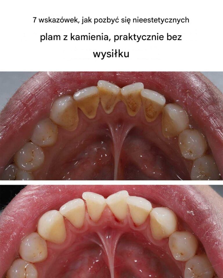 7_wskaz_wek__jak_pozby__si__nieestetycznych_plam_z_kamienia__praktycznie_bez_wysi_ku