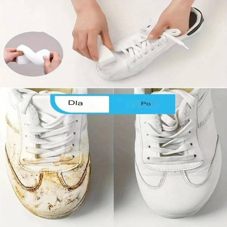Bardzo_bia_e_buty__tylko_wybielacz__tak_znikaj__wszystkie_plamy___Teraz_wszyscy_to_robi_