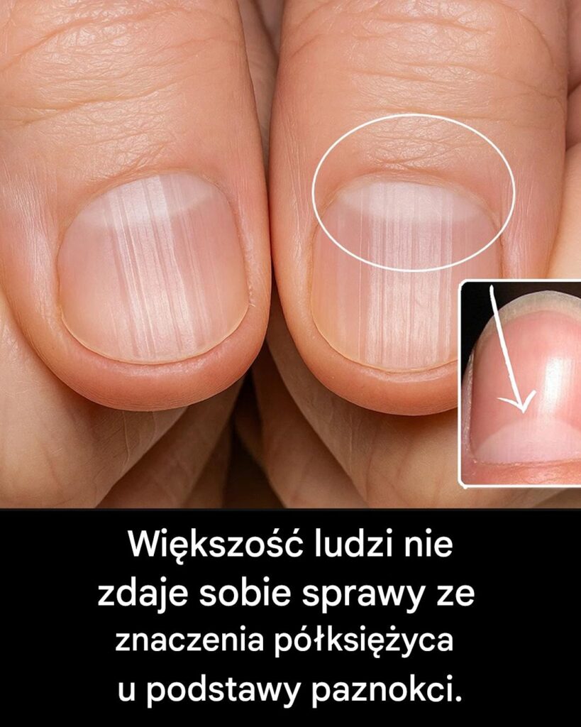Co_oznacza_p__ksi__yc_u_podstawy_paznokci_ Co_oznacza_p__ksi__yc_u_podstawy_paznokci_